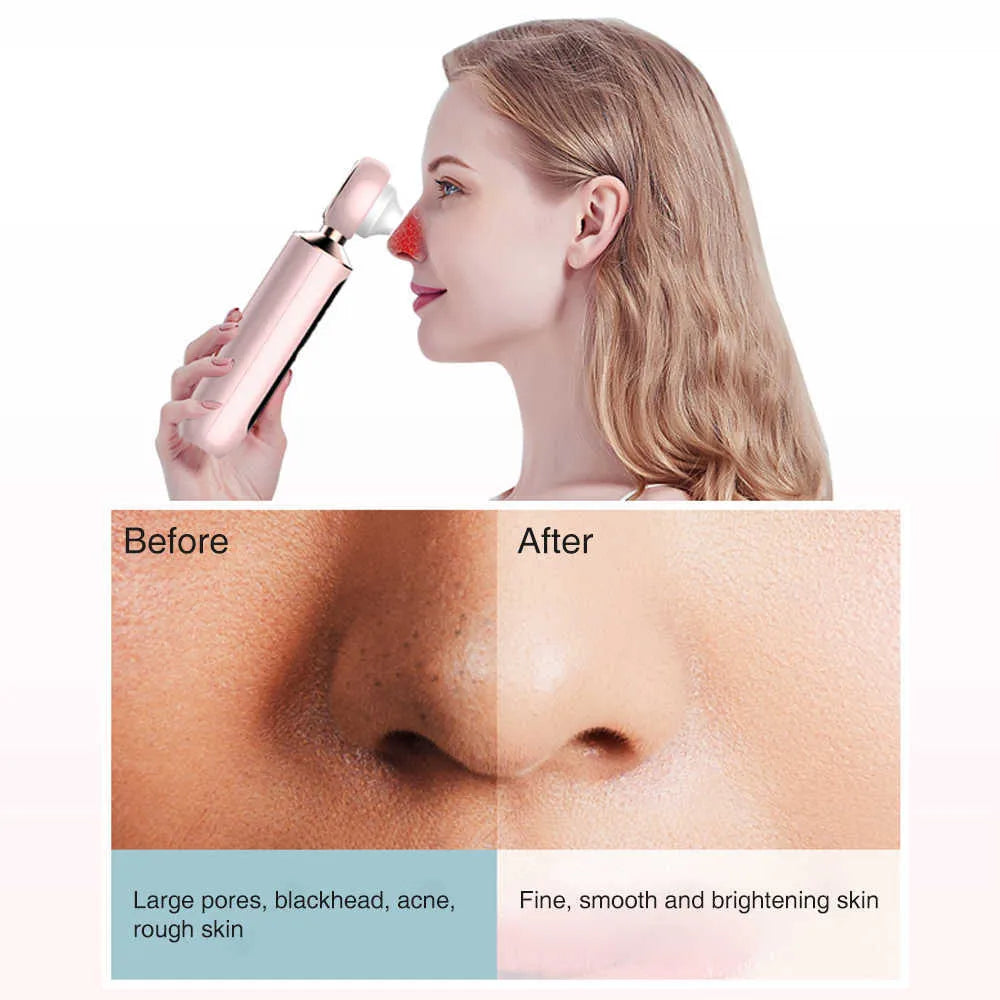 ᴢʏʀᴀʜᴜʙ™ Blackhead Suction Machine