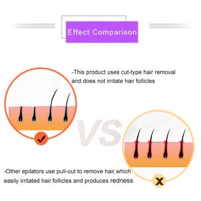 ᴢʏʀᴀʜᴜʙ™Purple Epilator – آلة إزالة الشعر البنفسجية