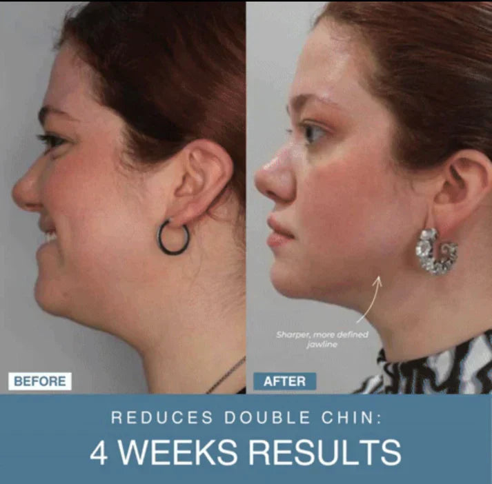 ᴢʏʀᴀʜᴜʙ™ 7-in-1 LED Anti-Aging/Wrinkle Apparatus