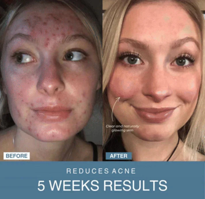 ᴢʏʀᴀʜᴜʙ™ 7-in-1 LED Anti-Aging/Wrinkle Apparatus